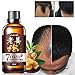 DAGEDA New Ginger Hair Growth Oil Essence, Stops Hair Loss, Dense Thicken Hair, Treatment Balding Supports Healthy Hair Growth for Women & Men （30ml）
