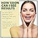 24k Gold Cream – Face Lifting & Firming Wrinkle Cream | Anti Wrinkle Cream for Women & Men | Firms & Tightens | Use as Day Moisturizer to Reduce Appearance Of Wrinkles and Fine Lines ● 50MLthumb 2