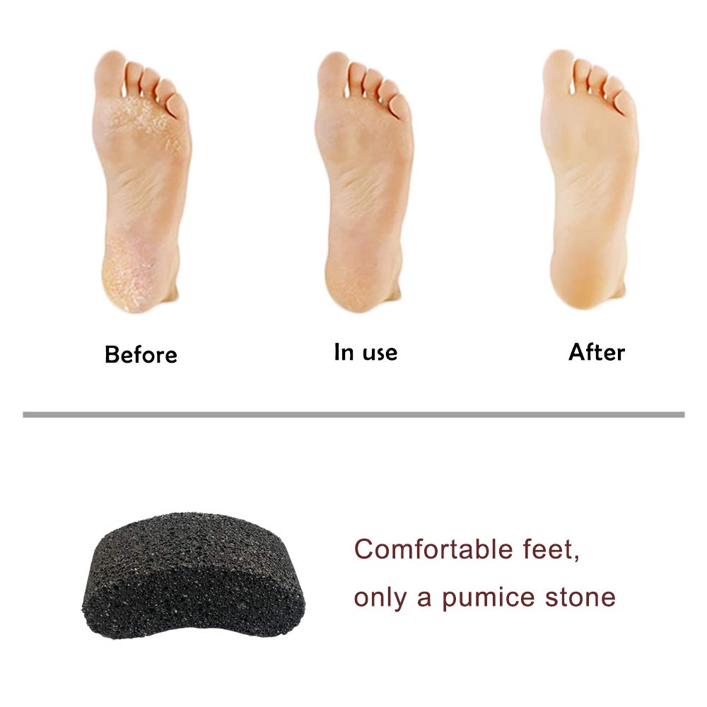 Bicrops Natural Lava Pumice Stone, Pedicure Tool, Hard Callus Dead Skin Remover, Foot File For Exfoliation & Fine Foot Scrubber for Smoothing & Softening Skin: Beauty