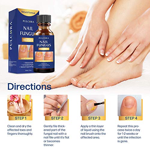 Nail Fungus Treatment Perfect for Both Toenails and Fingernails, for
