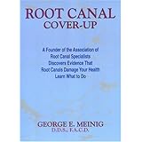 Root Canal Cover Up
