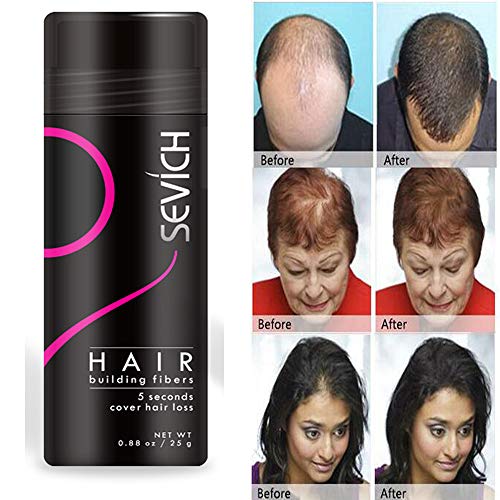 Economy Keratin Hair Building Fibers Instantly Thickens Thinning or Balding Hair for Men and Women - Natural Hair Loss Concealer 0.87oz (Medium Brown) - Thumbnail 3