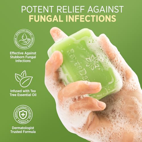 Roycederm Antifungal Antibacterial Tea Tree Soap: Antifungal Antibacterial Treatment for Face & Body Acne, Athlete's Foot, Tinea, Folliculitis Ringworm Jock Itch (Pack of 1)