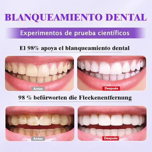 Professional Teeth Whitener, Teeth Whitening Powder, Effective to Strengthen Teeth and Gums, Long Lasting Teeth Whitening, Gentle for Sensitive Teeth, Removes Years of Stains (Purple1227)