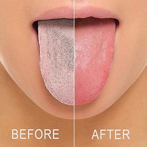 Tongue Scraper Cleaner With Travel Handy Case, Stainless Steel Tongue Cleaners For Healthy Oral Care For Adults For Kids(4-pack)