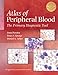 Atlas of Peripheral Blood: The Primary Diagnostic Tool