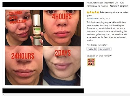 does witch hazel remove acne scars