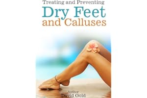Treating And Preventing Dry Feet and Calluses How To Remove Calluses From Feet - Pedi Spin Callus Remover