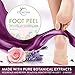Exfoliating Foot Peel Mask 2 Pair - Baby Soft & Smooth Feet - Gentle Exfoliation Treatment To Remove Rough Dead Skin & Calluses - For Men & Women