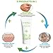 Eczema cream LEMYKA, Natural anti itch relief, hives, Contact Dermatitis Treatment, Itchy dry skin, Dyshidrosis, diaper rash cream, Steroid free, pure plant actives: 10X Shea, aloe vera, ceramides