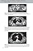 Chest X-Ray Made Easy