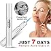Eurobuy Powerful Anti-varicose Veins Face Acne Removal Pen (Battery not included)(Style A)