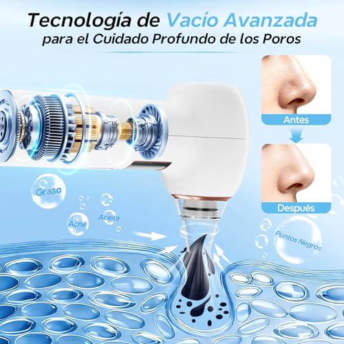 Succionador de Puntos Negros Extractor Limpiador de Poros Limpiador Puntos Negros con Calor - 3 Modos 5 Boquillas Eléctrico Quitar Puntos Negros Nariz Aceites y Espinillas Facial Hogar | Limpieza Facial y Nasal Kit de Espinillas para Eliminar Comedones y Acné Graso,Blackhead remover pore vacuum