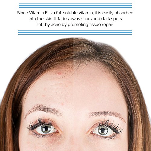 Vitamin E Oil, 100% Natural - Skin Nourishment & Renewal - Natural ...