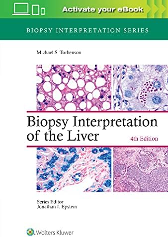 MacSween's Pathology of the Liver: 9780702082283: Medicine