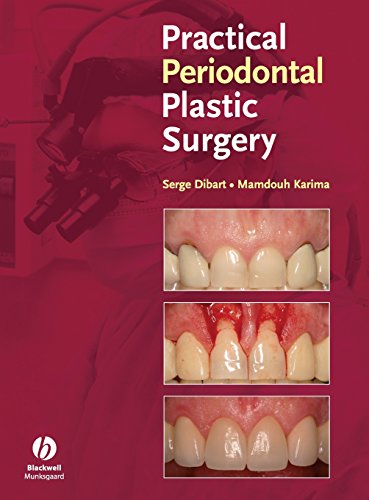 Practical Periodontal Plastic Surgery
