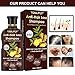 Hair Regrowth Shampoo,Hair Loss Shampoo,Hair Growth Shampoo,Ginger Shampoo,Hair Thickening Shampoo,Hair Loss Treatments Anti Hair Loss for Thinning Hair Women Menthumb 1