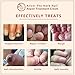 2 Pcs Nail Fungus Treatment, Anti Fungus Nail Treatment, Foot Nail Repair Cream Protector Skin Care Cream, Herb Anti Fungal Nail Repair Cream, Removes Yellow from Infected Finger & Toe Nails