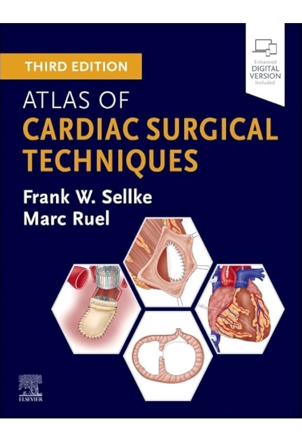 Cardiac Surgery: Operative Technique - Expert Consult: Online and