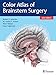 Color Atlas of Brainstem Surgery