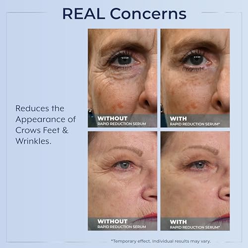 Plexaderm Rapid Reduction Eye Serum - Visibly Reduces Under-Eye Bags, Wrinkles, Dark Circles, Fine Lines & Crow's Feet Instantly, Anti Aging Wrinkle Remover for Face, 30 Single Use Pods