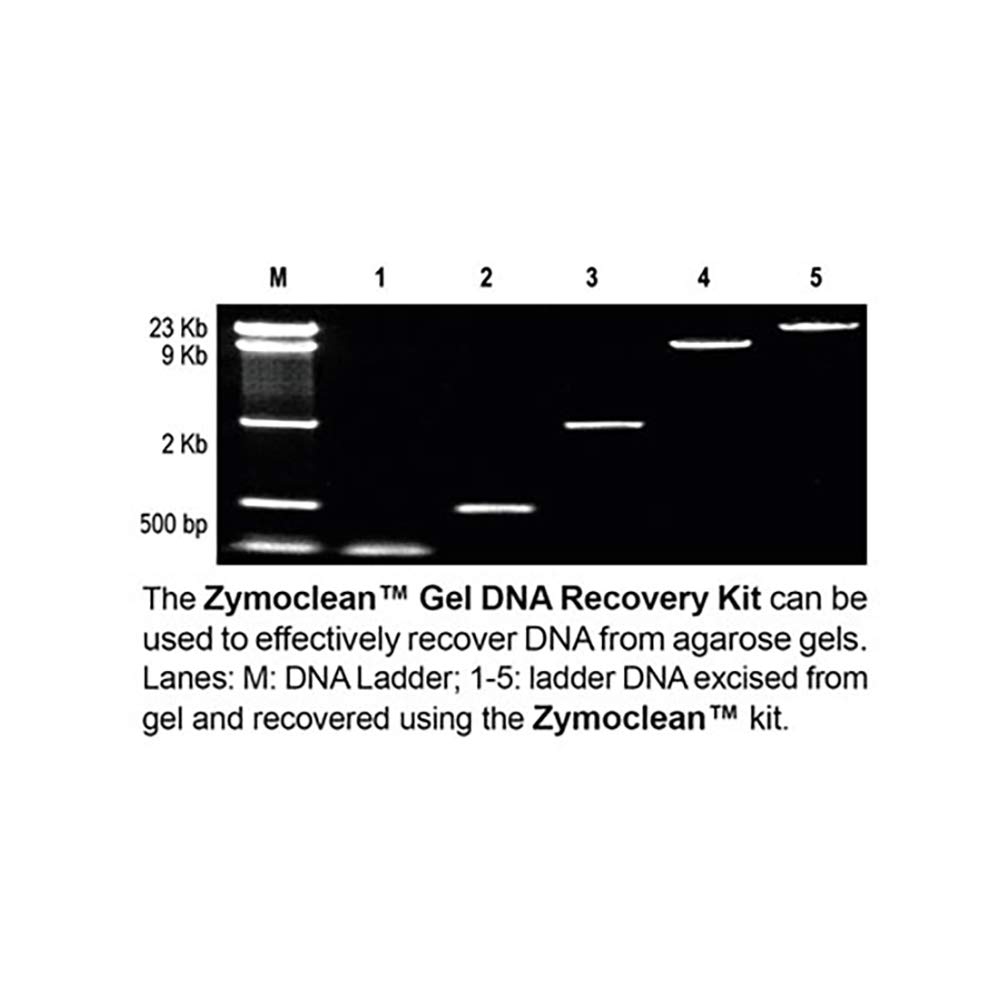 amazon com zymoclean gel dna recovery