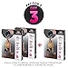 Knee Sleeves Only For Women By Smalets – 5 mm Neoprene Compression Support For Weightlifting & Powerlifting, Crossfit & Squats – Knee Brace For the Best Running - 15 Months Warranty – Black, XS