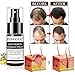 Hair Growth Product, Hair Regrowth, Hair Growth Essence Spray, Hair Loss Prevention, Hair Loss &Hair Thinning Treatment, Stimulates New Hair Growth, Best Treatment for Hair Lossthumb 4
