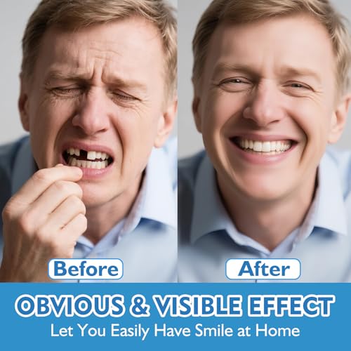 Moldable False Teeth - Veneers Teeth for Women & Men, Silicone Dentures Set for Both Upper and Lower, Temporary Dentures DIY at Home Within Minutes Fix Your Smile-001