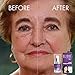 Glissé by Colageina 10 Instant wrinkle remover gel. Reduce the appearance of lines and eye puffiness, skin lifting with tightening effect that lasts up to 8 hours. Visible results in 90 secs or less