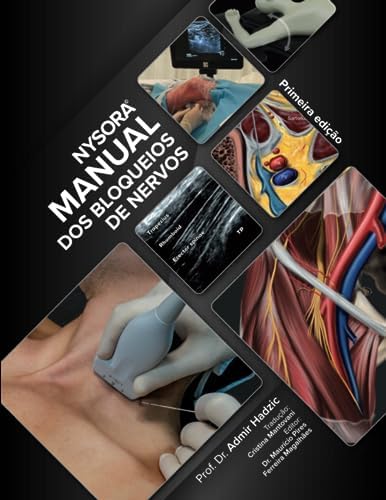 NYSORA Nerve Block Manual: First Edition (Regional Anesthesia