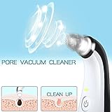 Electric Blackhead Remover, QQCute Comedo Suction Microdermabrasion Machine Rechargeable Facial Pore Cleaner Skin Peeling Machine Comedone Extractor Tool Black