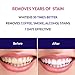 AsaVea Teeth Whitening Pen (2 Pack), Safe 35% Carbamide Peroxide Gel, 20+ Uses, Effective, Painless, No Sensitivity, Travel-Friendly, Easy to Use, Beautiful White Smile, Natural Mint Flavor