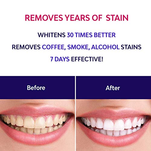 AsaVea Teeth Whitening Pen (2 Pack), Safe 35% Carbamide Peroxide Gel, 20+ Uses, Effective, Painless, No Sensitivity, Travel-Friendly, Easy to Use, Beautiful White Smile, Natural Mint Flavor