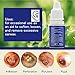 Earache Drops&Ear Infection Drops, Earwax Removal Aid Drops, Clean The Earwax and Relieve The Outer Ear