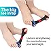 Bunion Corrector, 9 pcs Bunion Corrector and Bunion Relief, Bunion Night Splint with Super Soft Gel for Foot Pain Relief, Hallux Valgus Splint Aid Surgery Treatment Toe Separators Straighteners