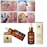 Hunputa Fungus Stop. Effective against 99.9% of nail fungus.Anti fungal Nail Solution. Toenails & Fingernails Solution.