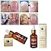 Hunputa Fungus Stop. Effective against 99.9% of nail fungus.Anti fungal Nail Solution. Toenails & Fingernails Solution.