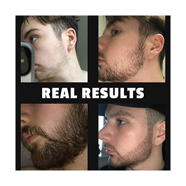 Red-Blooded Beard Growth Roller | Stimulate Beard and Hair Growth | 540 0.5mm Titanium Needles | Derma Roller For Men…