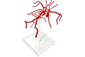 EVOTECH SCIENTIFIC Brain Artery Model, Life Size Intracranial Artery Model, Shows Internal Carotid Artery, Willis Circle and Basillary Artery & Their Branches. On a Plexiglass Base