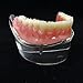 Smile1000 Dental Model Overdenture Inferior 2 Implants Demo for Studing and Teaching