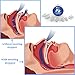 Stop Snoring Nose Vents by KOIIAN - Safe and Comfortable Anti Snore Solution - BPA Free with High Quality Medical Grade Silicone - Set of 4 Different Sizes and Travel Case