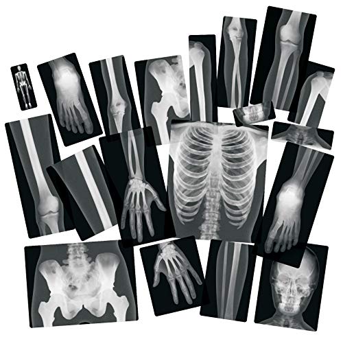 Roylco True to Life Human X-Rays - Thumbnail 2