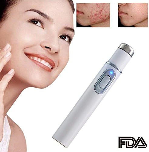 2018 Spider Vein Eraser Pen,Powerful Blu-Ray Anti-varicose Veins Acne Removal Pen (White)