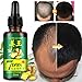 Hair Growth Liquid Hair Loss Care 30ML