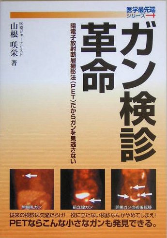 ガン検診革命 陽電子放射断層撮影法 Pet だからガンを見逃さない 医学最先端シリーズ 山根 咲栄 本 通販 Amazon ガン検診革命 陽電子放射断層撮影法 Pet だからガンを見逃さない 医学最先端シリーズ 山根 咲栄 本 通販 Amazon