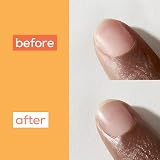 essie Nail and Cuticle Oil Treatment Apricot 13.5ml Nourishing Moisturising view 7