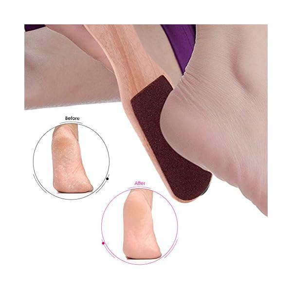 Anself-Double-Sided-Foot-Rasp-Manicure-File-Callus-2-Sided-Wooden-Foot-File-Hard-Skin-Remover-and-Callus-Removal-Reusable-Foot-Rasp-for-Callus-Trimming-Callus-Removal-Manual-Pedicure-File Anself Double Sided Foot Rasp Manicure File Callus Remover Pedicure Tool