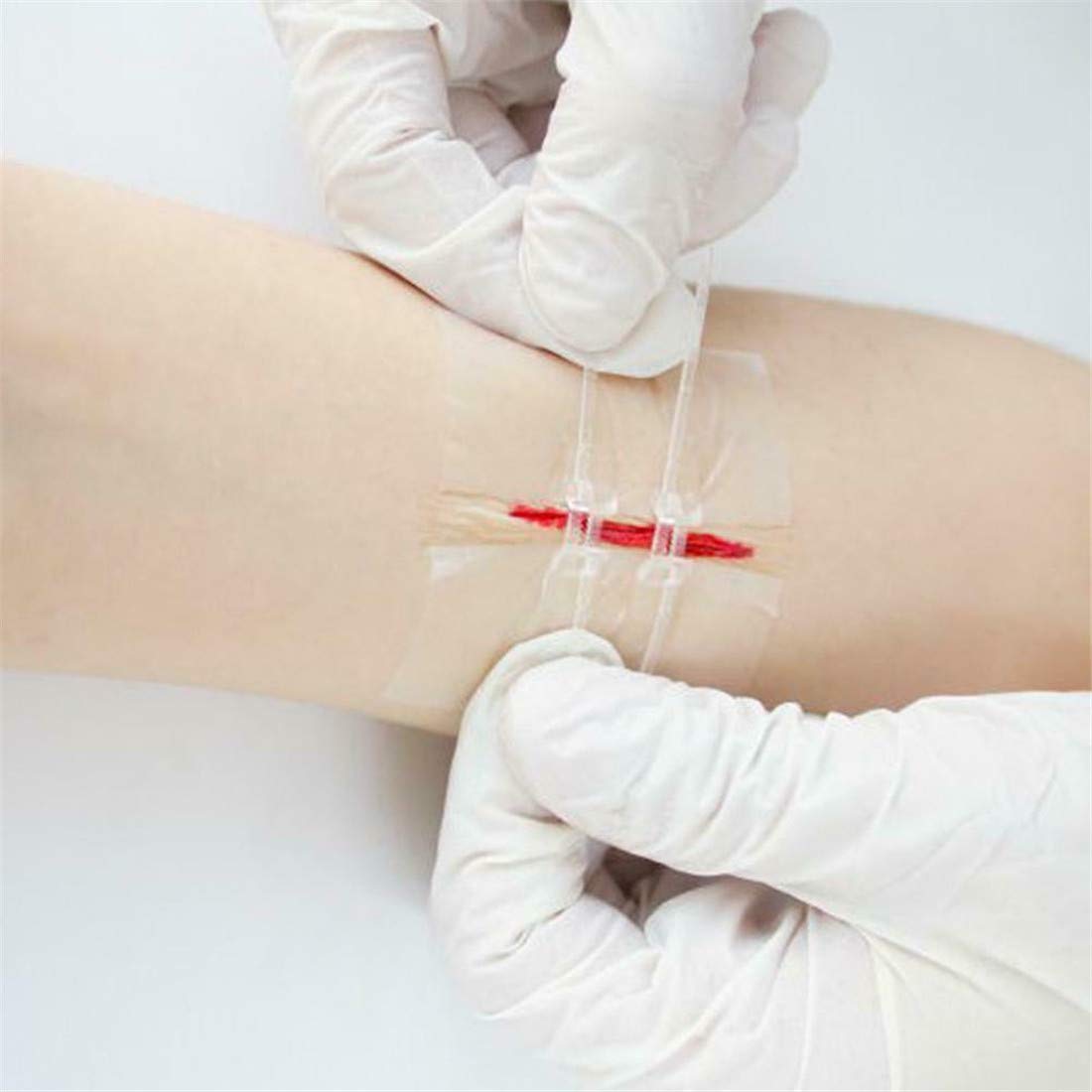 Buy Egmystic Zipper Bandaid SutureFree, Emergency Laceration Closures, Wound Closure Device