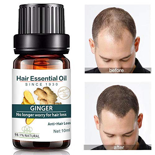 Kasien Hair Growth Liquid, Natural Ginger Hair Growth Essence liquid Fast Hair Growth Natural Hair Loss Treatment (3 Pcs)